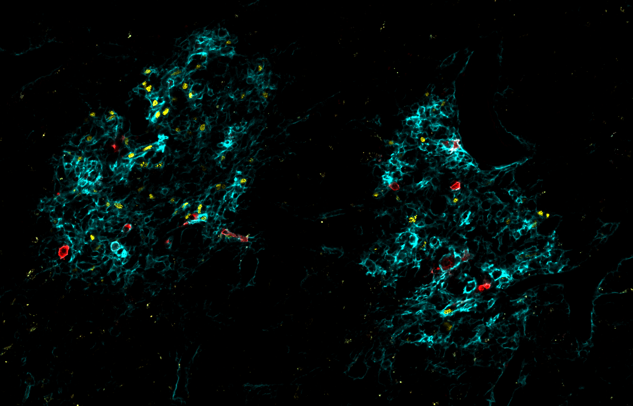 Thymic epithelial cells stained for EpCAM, GP2, and Aire